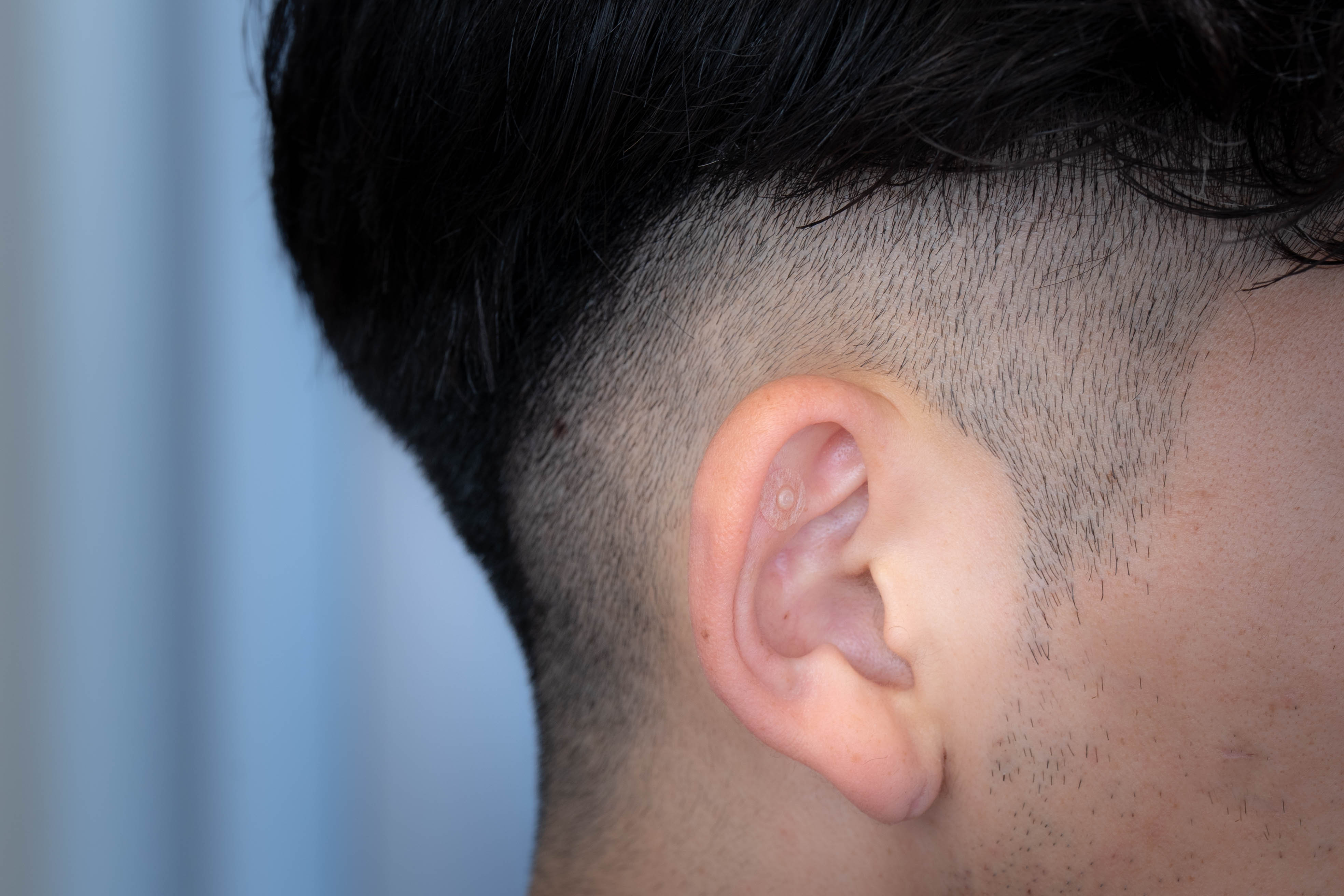 家庭用貼付型接触粒 こりスポッと