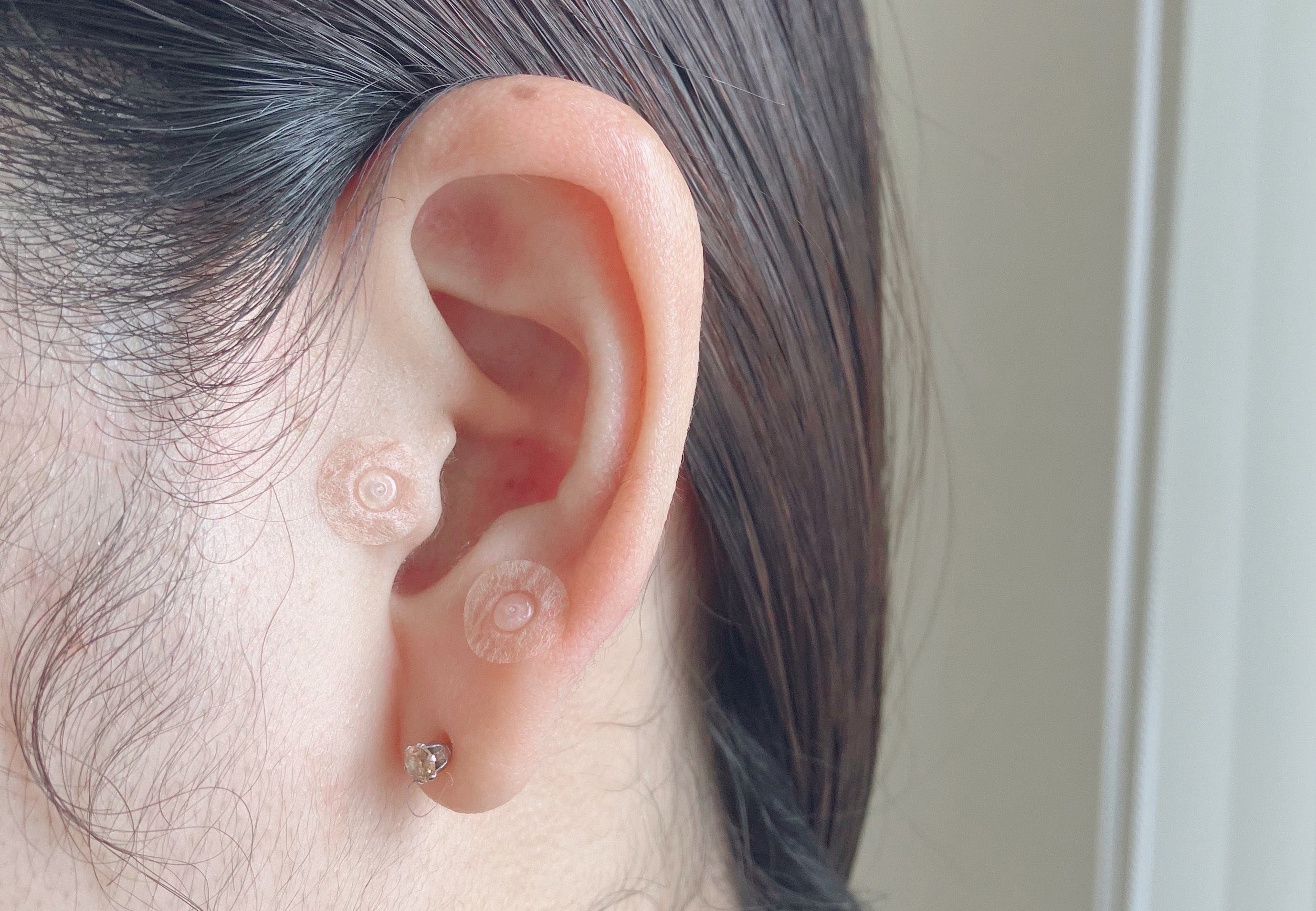 家庭用貼付型接触粒 こりスポッと